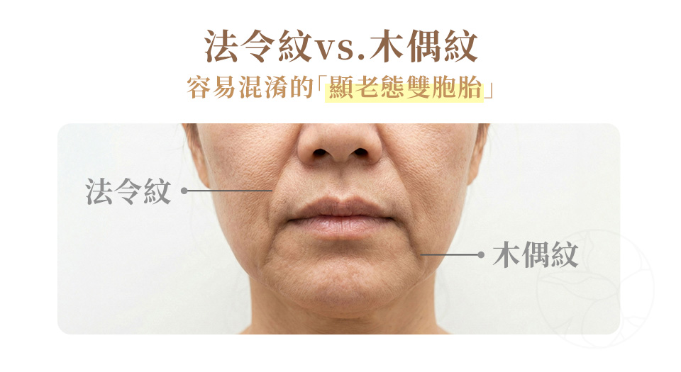 法令紋： 從鼻翼兩側延伸到嘴角。 木偶紋（Marionette Lines）： 從嘴角兩側延伸至下巴。