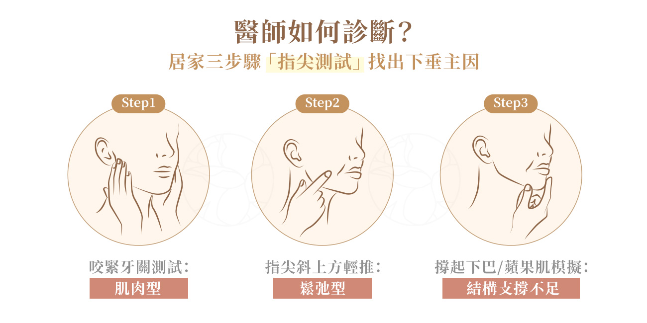 嘴邊肉3步驟自我檢視 Step 1：咬緊牙關測試：肌肉型&nbsp; Step 2：指尖斜上方輕推：鬆弛型 Step 3： 撐起下巴/蘋果肌模擬：結構支撐不足