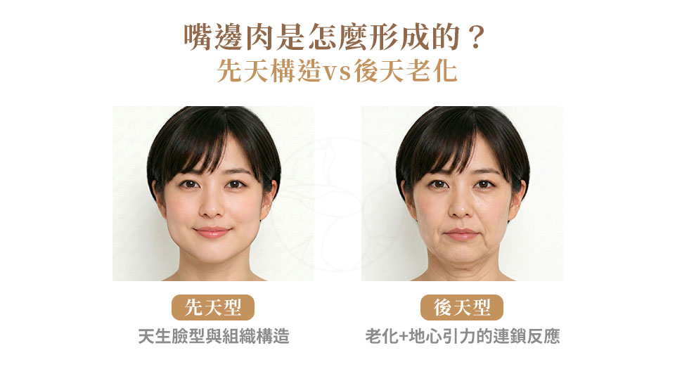 嘴邊肉是怎麼形成的？先天構造 vs 後天老化