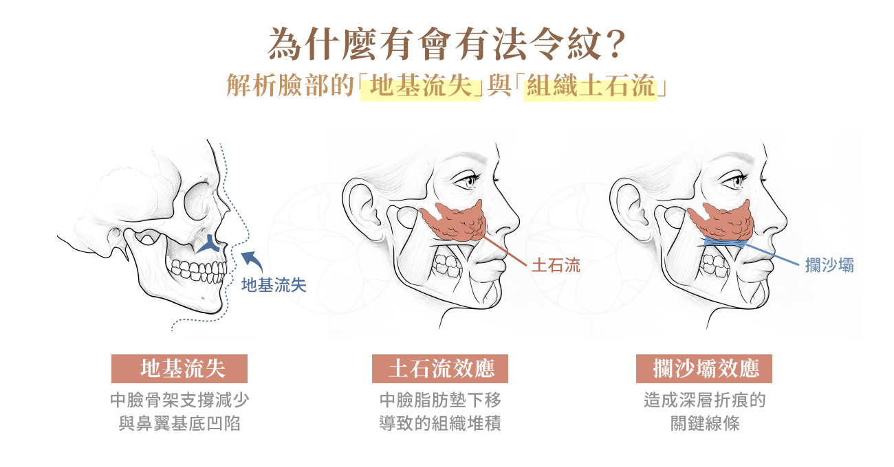 為什麼會有法令紋？解析臉部的「地基流失」與「組織土石流」