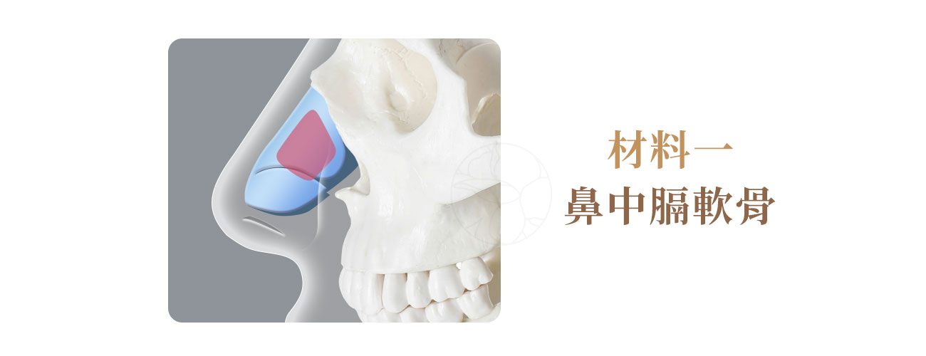自體隆鼻材料: 鼻中隔軟骨（Septal Cartilage）圖示