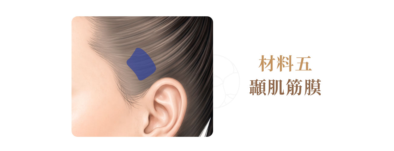 自體隆鼻材料: 顳肌筋膜圖示