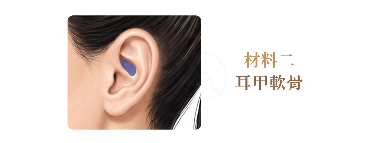 自體隆鼻材料: 耳甲軟骨圖示