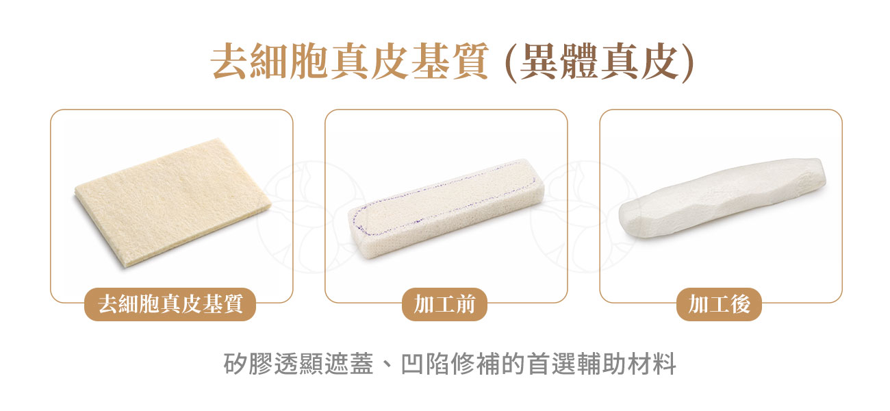 去細胞真皮基質-ADM(異體真皮)隆鼻：矽膠透顯遮蓋、凹陷修補的首選輔助材料