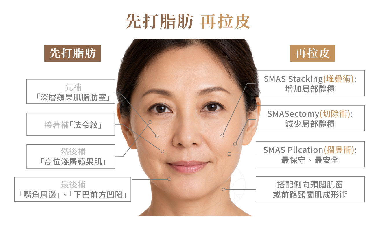 先補脂後拉皮 Lift-and-Fill 的做法則是:先把空掉的地方補滿,再把鬆的部分拉緊,讓臉重新變回「皮緊+肉飽」的年輕形狀。