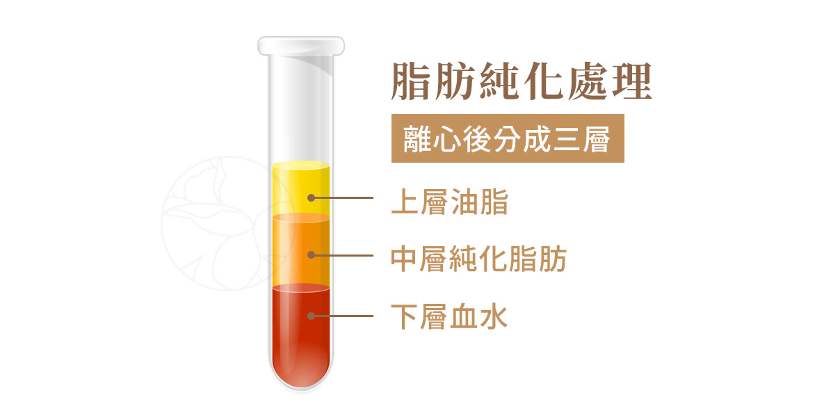 自體脂肪純化處理 1.從身體其他部位抽出脂肪(最常見是腹部、大腿、腰側)。 2.離心純化後取得上層油脂,中層純化脂肪。下層血水。