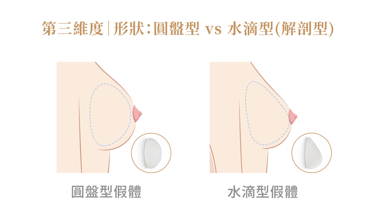 隆乳義乳第三維度 隆乳義乳第三維度|站立形狀:圓形義乳 vs 水滴形義乳比較