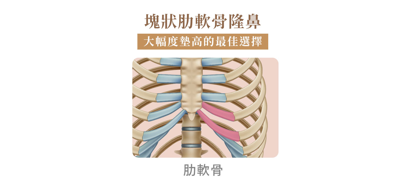 自體肋軟骨鼻背墊高 自體肋軟骨鼻背墊高