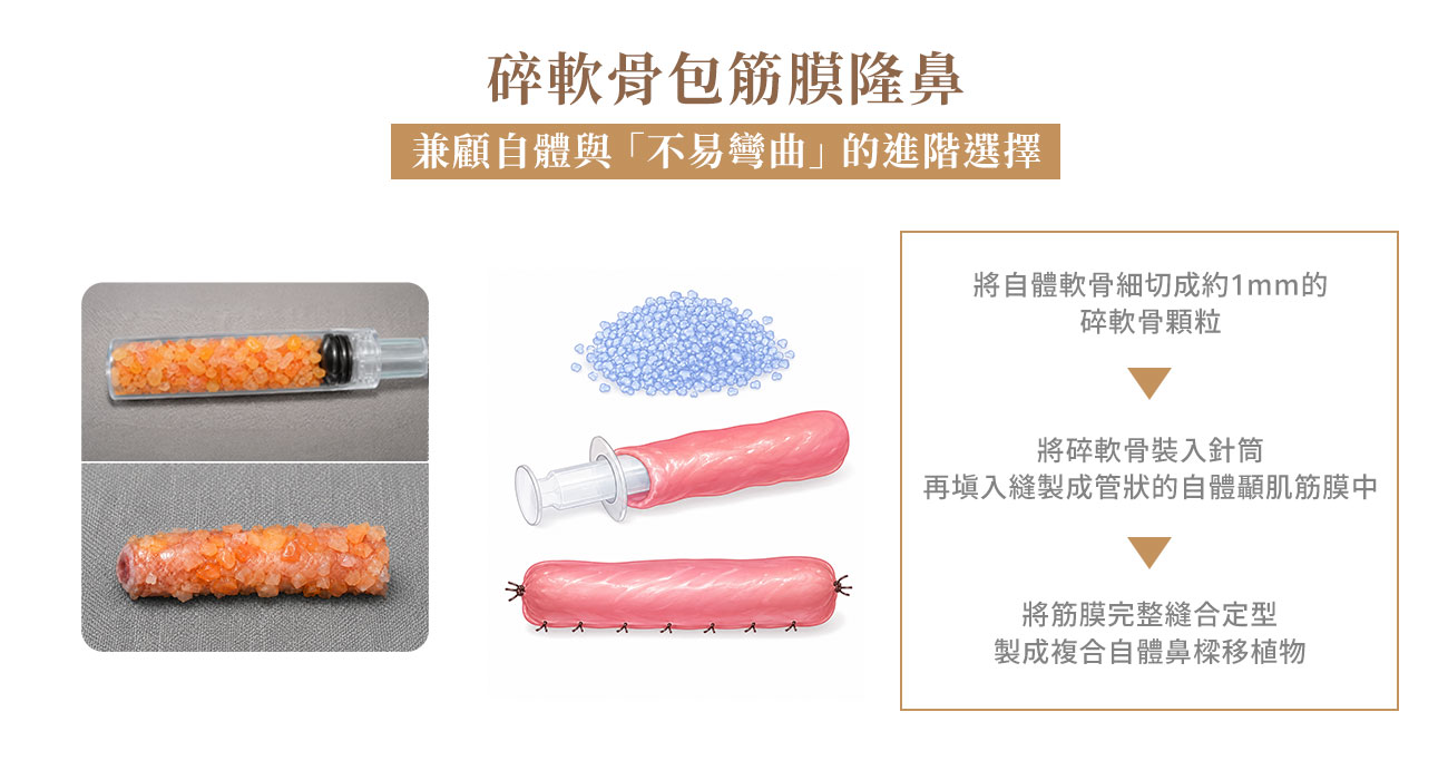碎軟骨包筋膜鼻背墊高(DCF|Diced Cartilage Fascia) 碎軟骨包筋膜鼻背墊高(DCF|Diced Cartilage Fascia)
