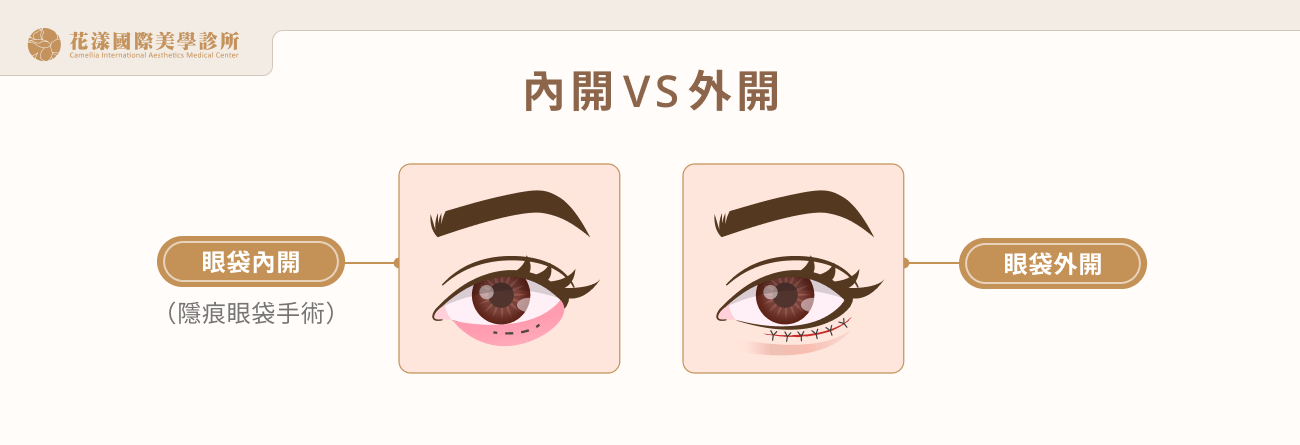 內開 VS 外開