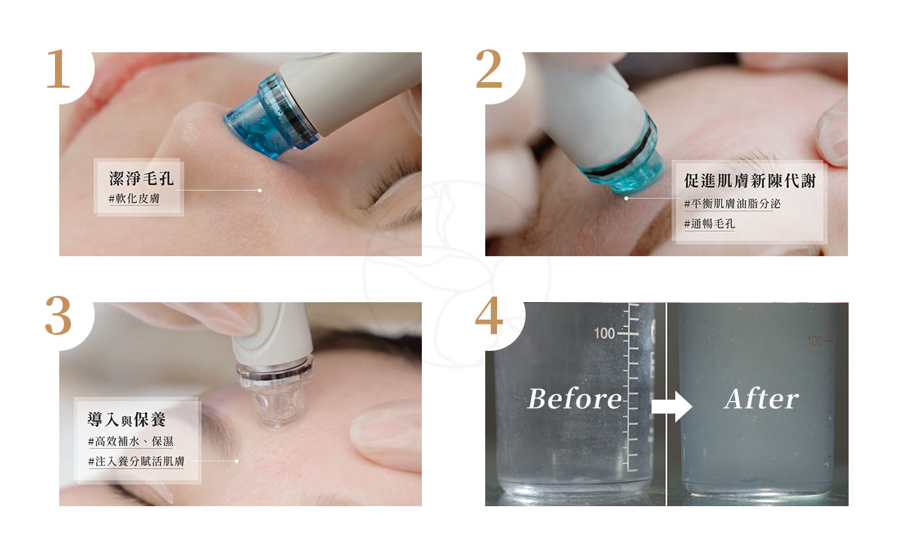 水飛梭好評案例 1