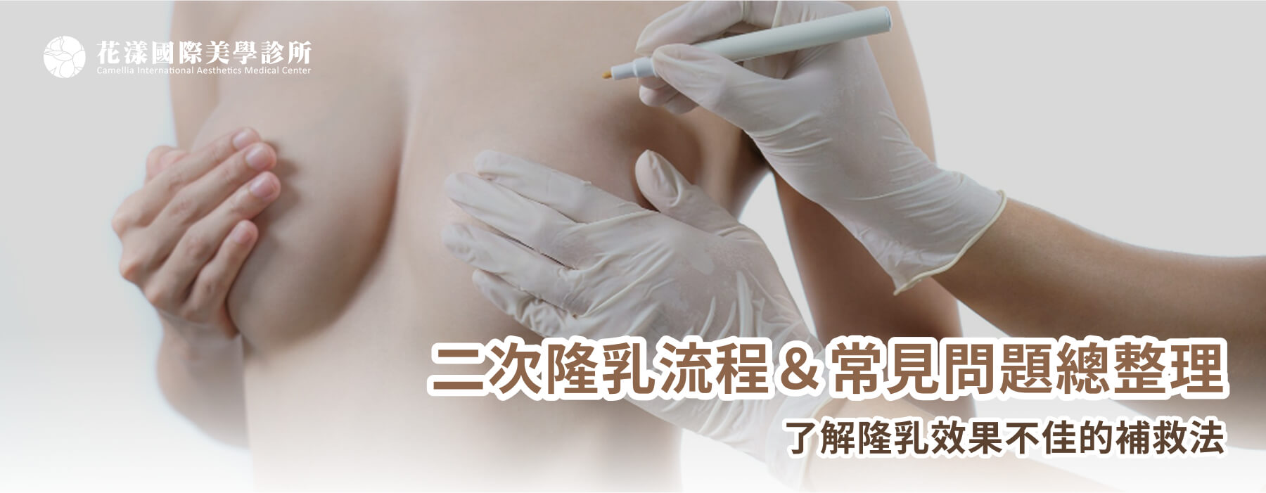 二次隆乳流程＆常見問題總整理，了解隆乳效果不佳的補救法