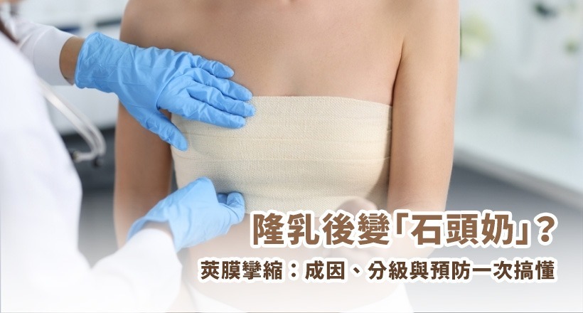 隆乳後遺症 莢膜攣縮 莢膜攣縮的成因, 分級與預防一次搞懂
