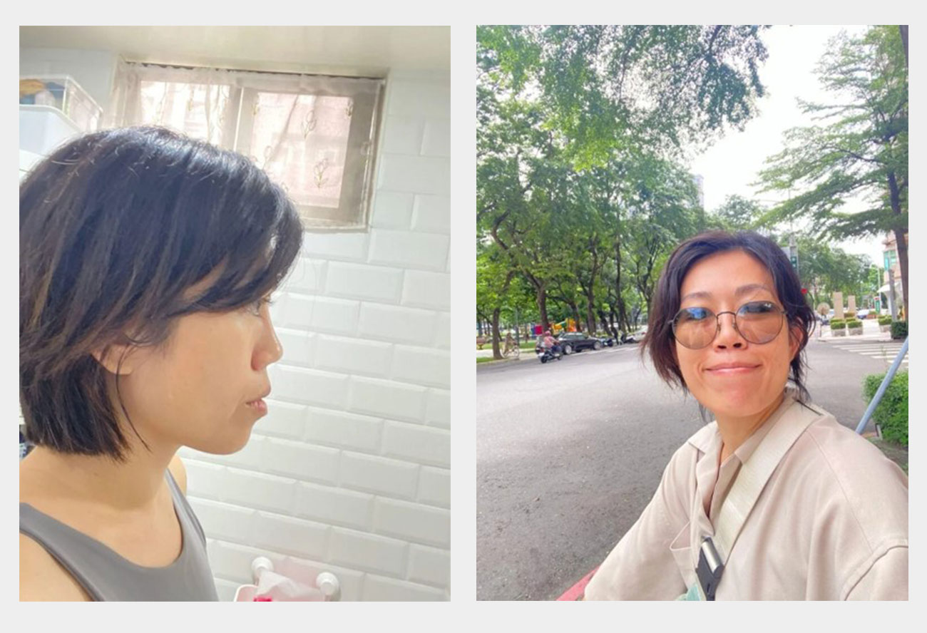 中年婦女第一次打音波｜極限音波＋海芙音波療程體驗分享