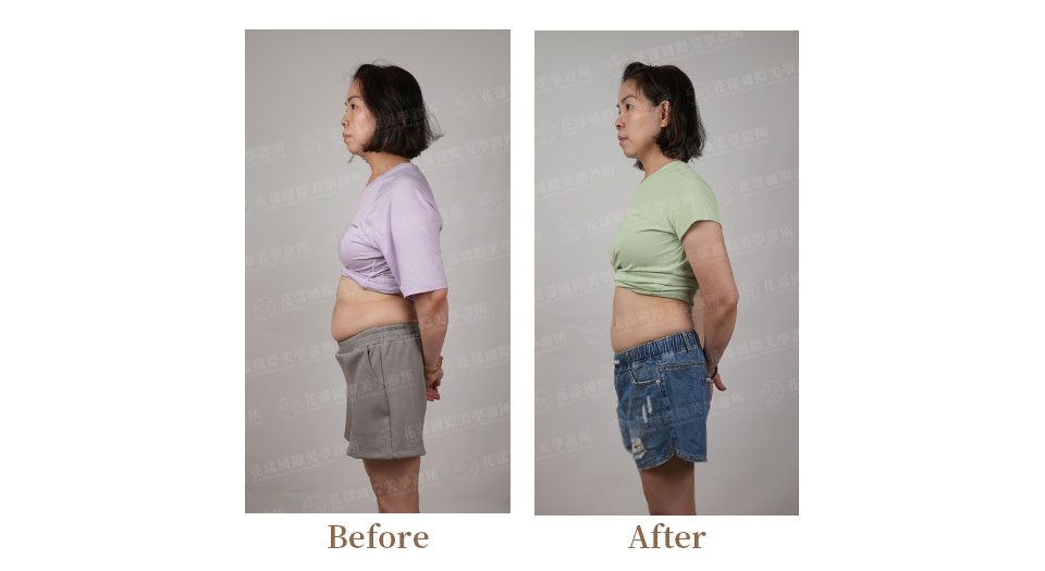 猛健樂案例 猛健樂案例前後比照