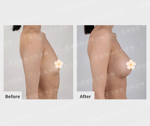 ALL_news_beautyshare_26A28_MuSE4nQxWy ALL_news_beautyshare_26A28_MuSE4nQxWy