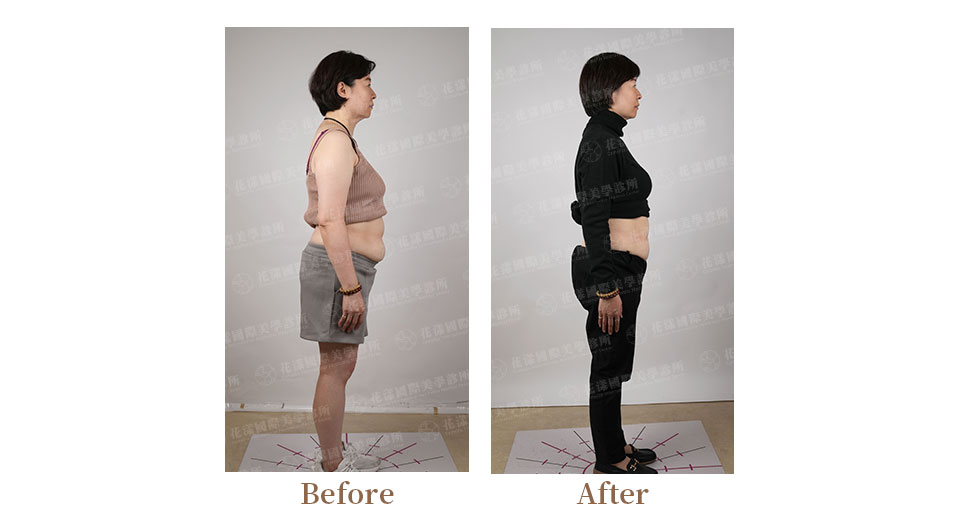 猛健樂案例前後比照