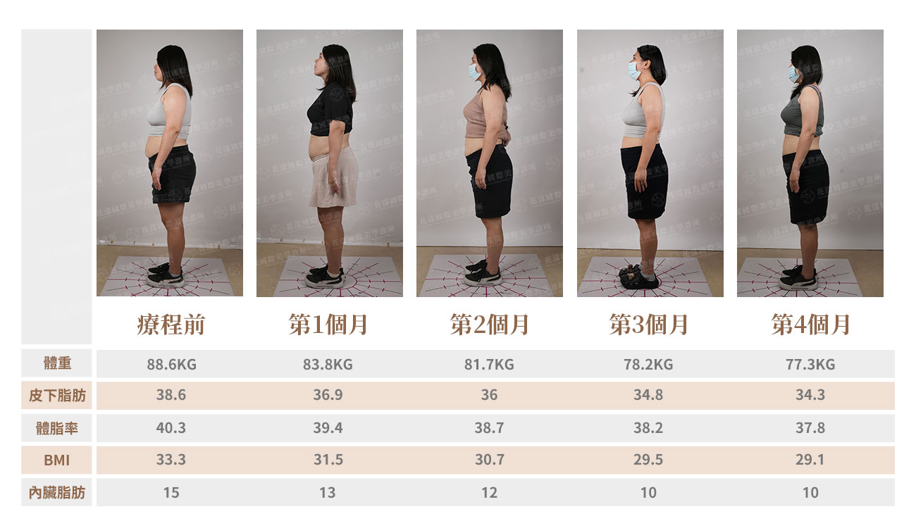 猛健樂案例 猛健樂案例:在醫師追蹤下建立體態掌控度