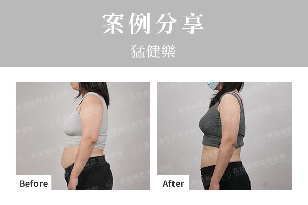 猛健樂案例 猛健樂案例:在醫師追蹤下建立體態掌控度