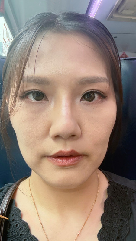 台北中山區花漾: 雙音波療程前自己拍照