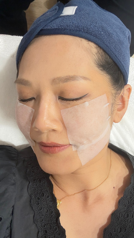 台北中山區花漾: 雙音波療程後的保濕及照護