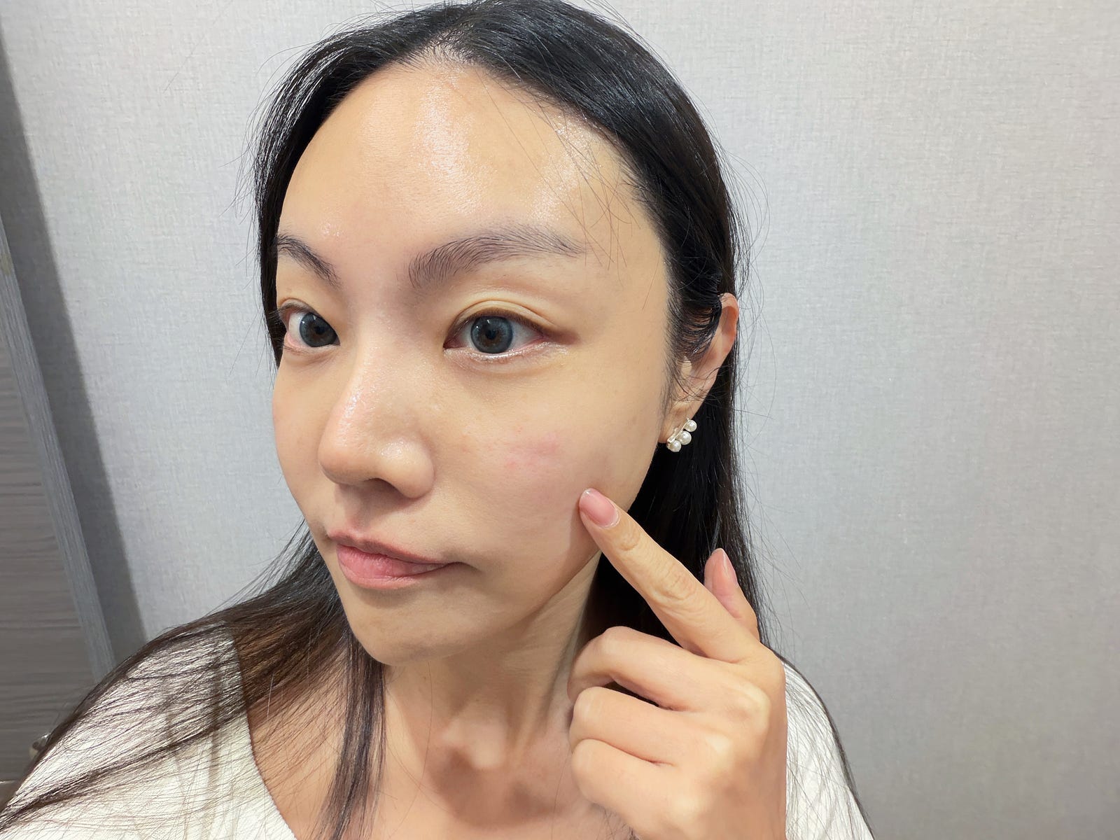 台北中山區花漾: 雙音波療程後的我