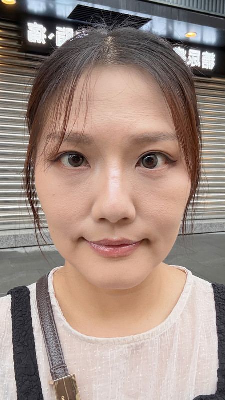台北中山區花漾: 雙音波療程後