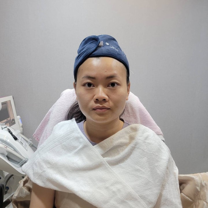 ALL_news_beautyshare_26H07_iL1EMU4Ljb 台北中山區花漾: 雙音波療程後的狀況